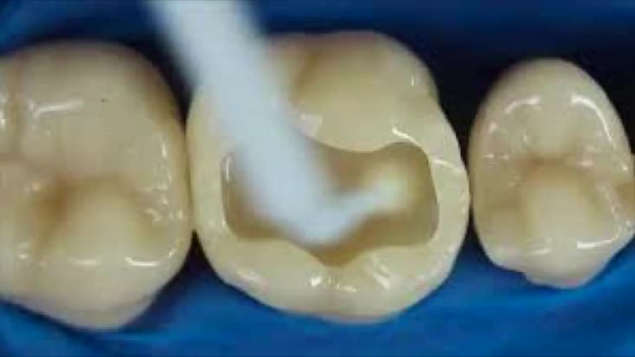 Diş ağrısını 1 dəqiqəyə yox edən təbii üsullar – 5 ÇARƏ