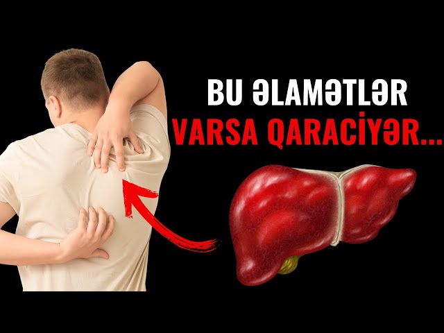 Qaraciyərdə xəstəlik ola biləcəyini göstərən 7 əlamət