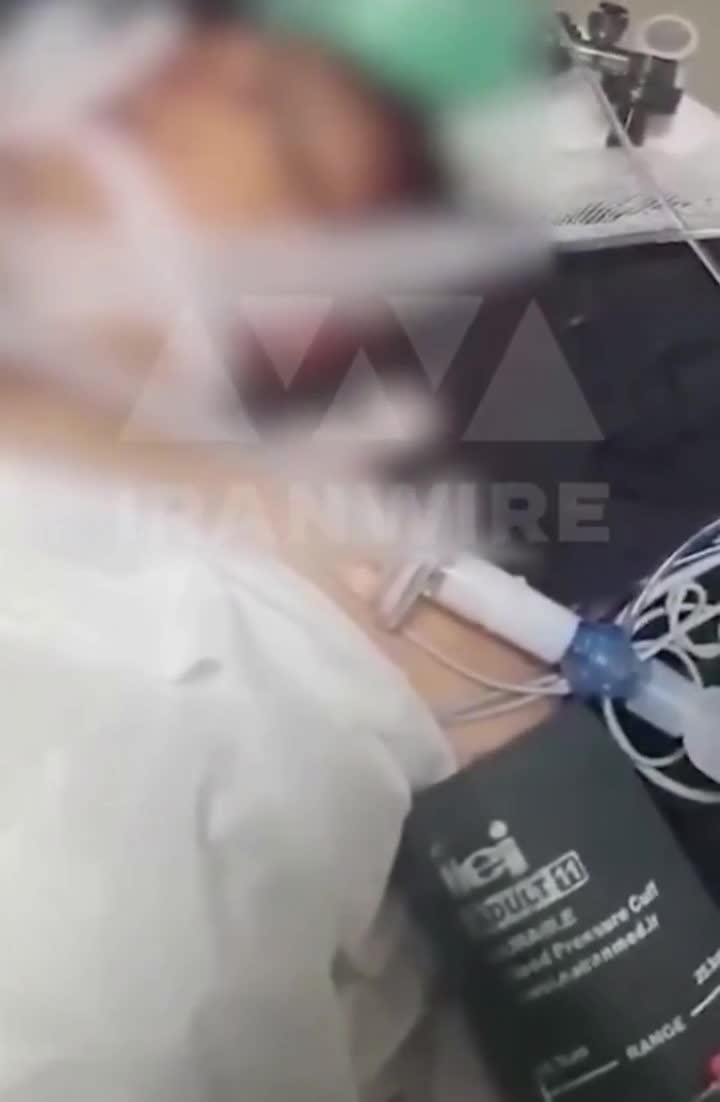 Etirazçıların bədənindən çıxarılan güllələr