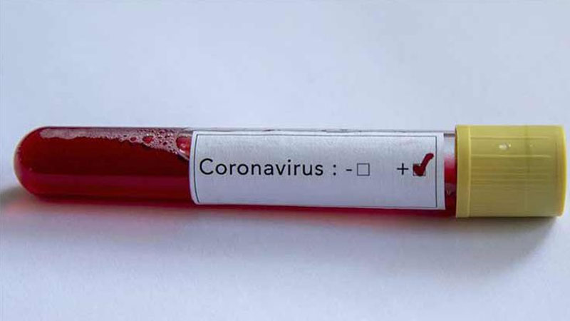 Koronavirusun dərmanı tapıldı - Şok açıqlama