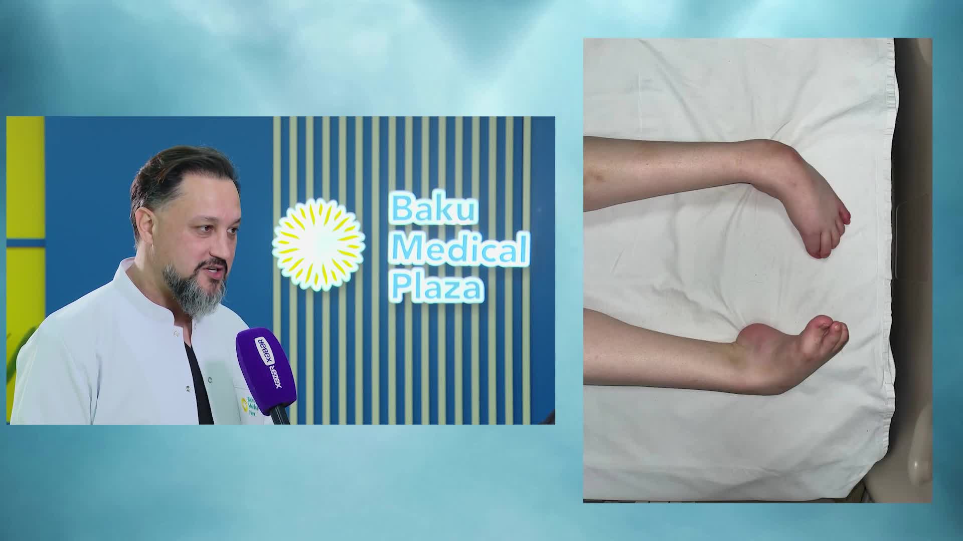 Hərəkət məhdudiyyəti olan pasiyent yeriməyə başladı